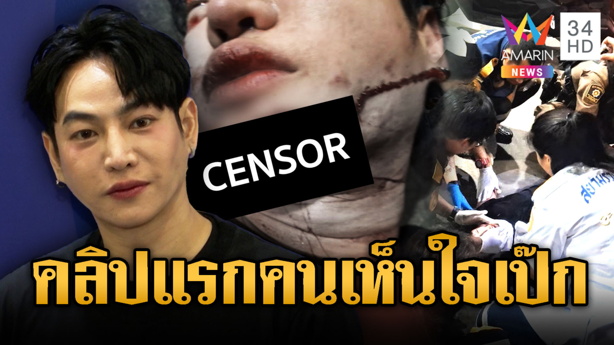 ช็อกวงการ“เป๊ก ผลิตโชค”ถูกฟันสาหัส