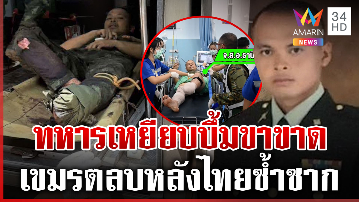 เขมรตลบหลังไทย วางระเบิดสังหารบุคคล ทหารเหยียบขาขาดเพิ่มอีก 1 นาย