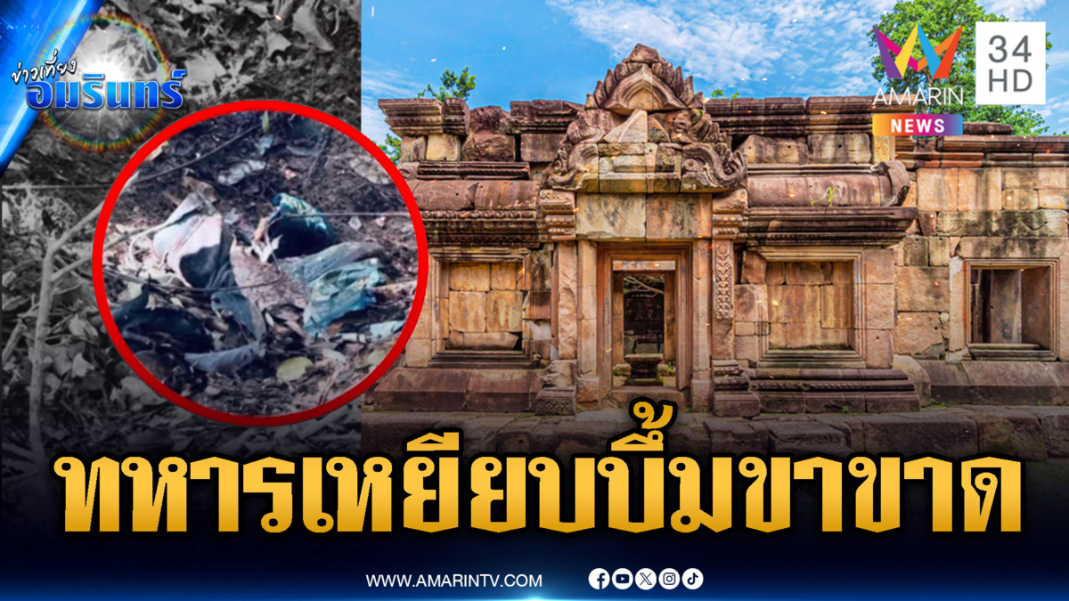 ด่วน! ทหารลาดตระเวนเหยียบกับระเบิดเขมร ขาขาดอีก 1