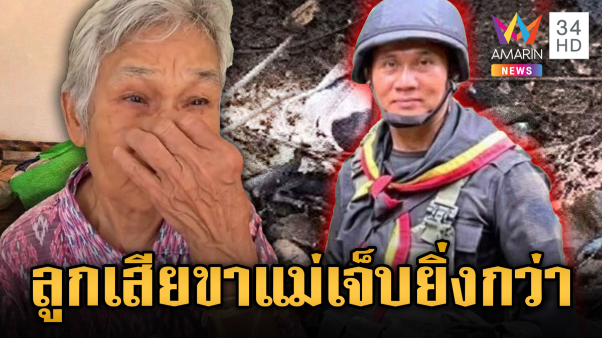 แม่น้ำตาคลอ ใจแทบสลายลูกชายเหยียบกับระเบิดขาขาด