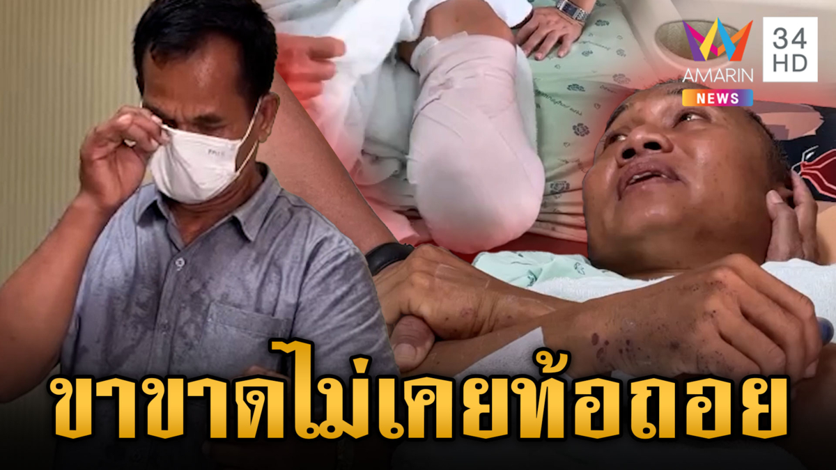 พี่ชายน้ำตาคลอเยี่ยม “ส.อ.ธีรพล” ขาขาดแต่ไม่เคยท้อถอย