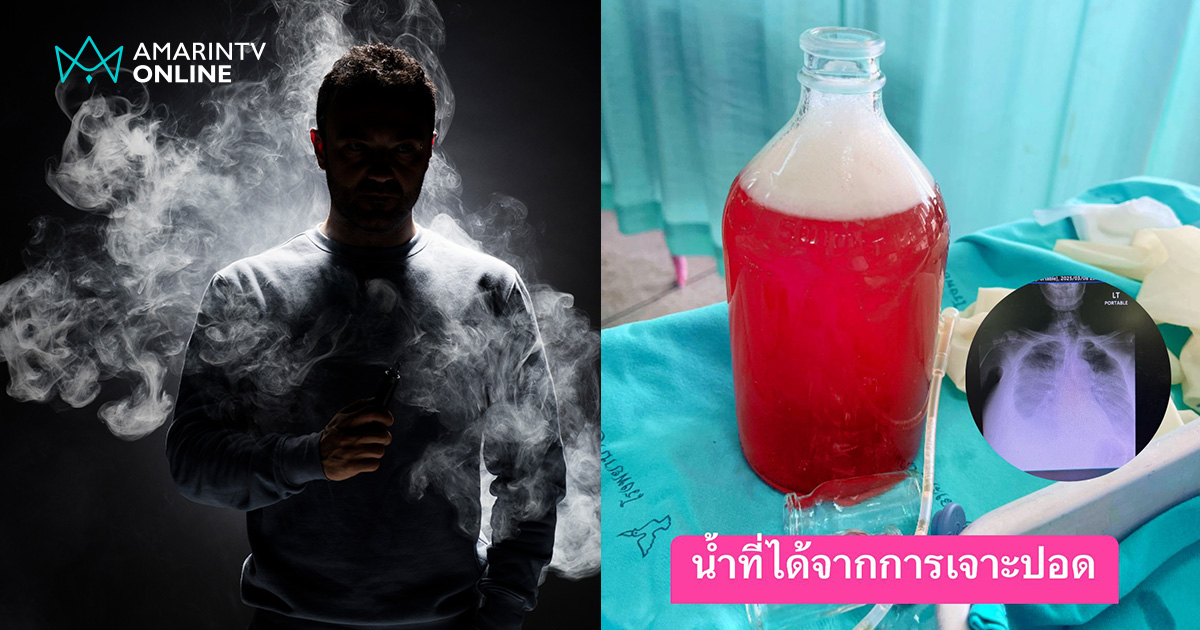 ผลของ บุหรี่ น้ำที่ได้จากการเจาะปอด สุดทรมานเหมือนปลาดิ้นทุรนอยู่บนบก