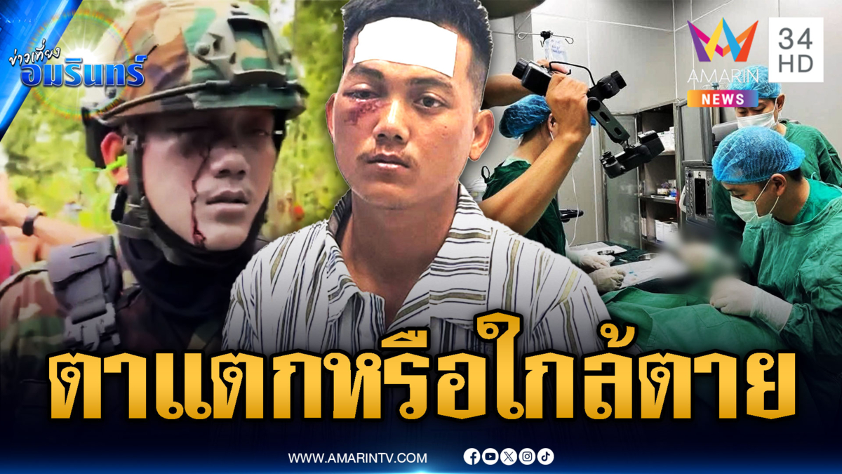ทหารเขมรฮีโร่ โดนกระสุนยางตาแตก ระดมหมอรักษา-ไข้สูง 78 องศาฯ