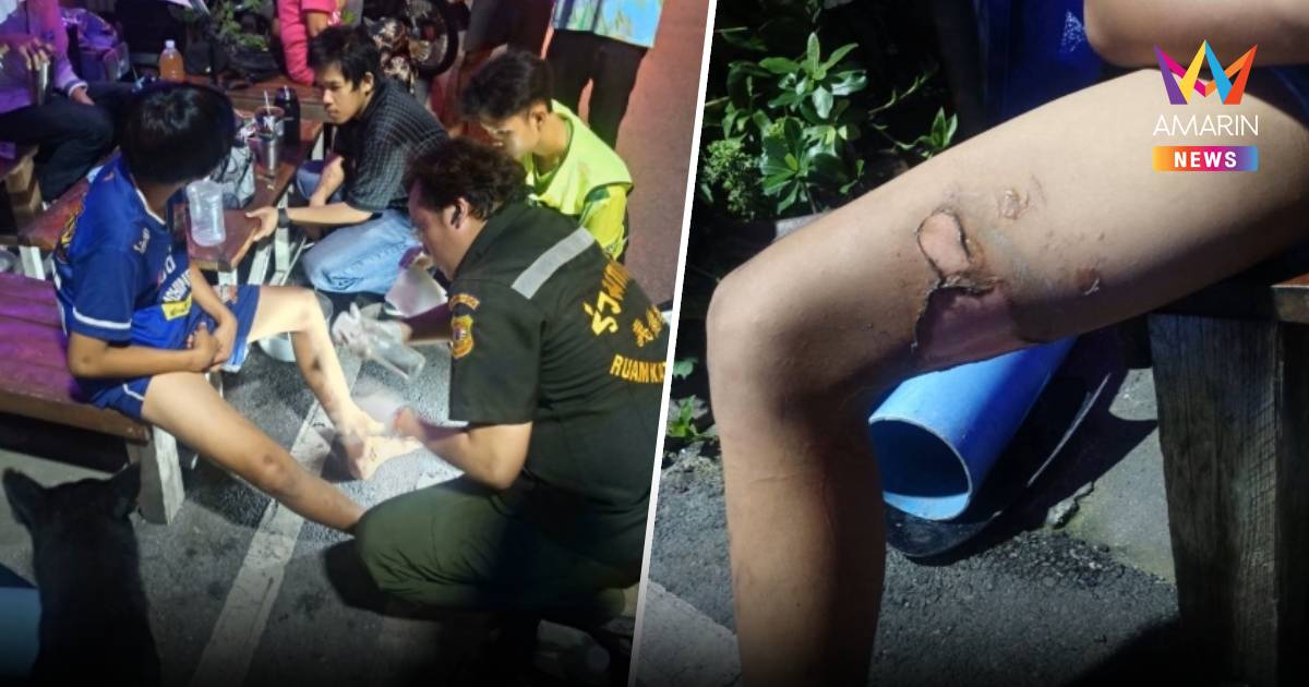 เล่นพิเรนทร์! เยาวชนชายวัย 12 ปี ถูกเพื่อนราดทินเนอร์จุดไฟเผาขา