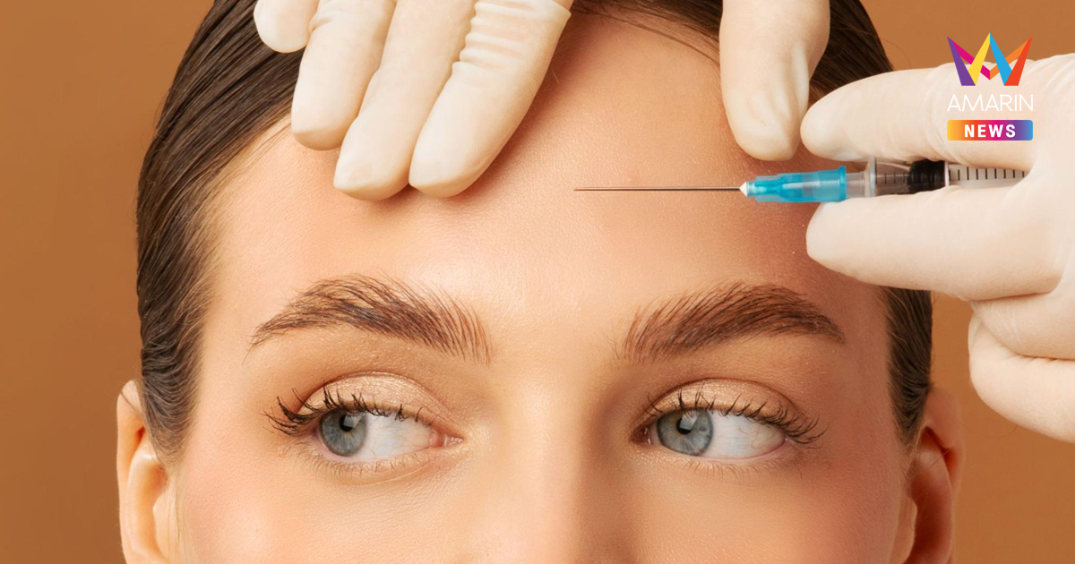 โปรแกรมฉีดฟิลเลอร์หน้าผาก ช่วยอะไร เหมาะกับใครบ้าง?