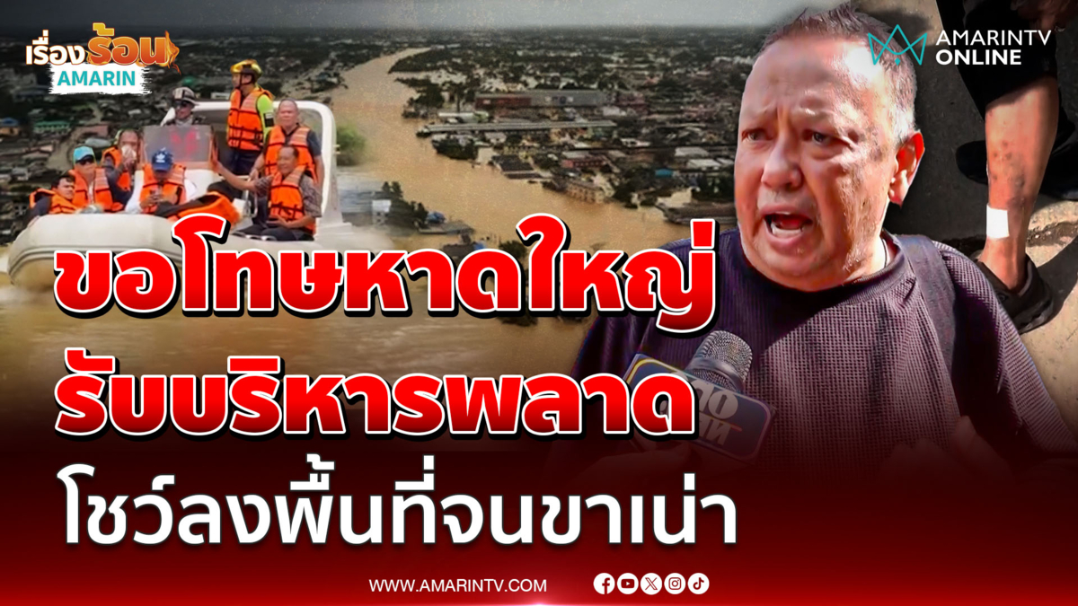 "นายกแป้น" ขอโทษพี่น้องหาดใหญ่ เปิดแผลโชว์ ลงพื้นที่จนขาเน่า