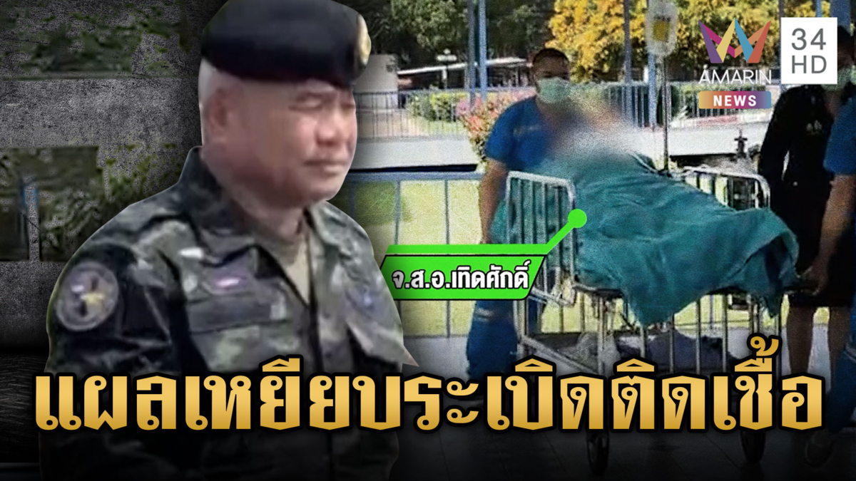 บิ๊กเติ่งเยี่ยม จ.ส.อ.เทิดศักดิ์ พบแผลติดเชื้อต้องผ่าตัดรอบ 2