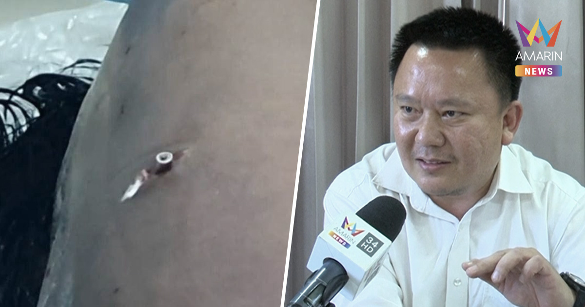 หมอหมูชี้บาดแผล ชาวเขมรไม่ตรงข้อกล่าวหา เหมือนถูกกรีดนำกระสุนมาวาง