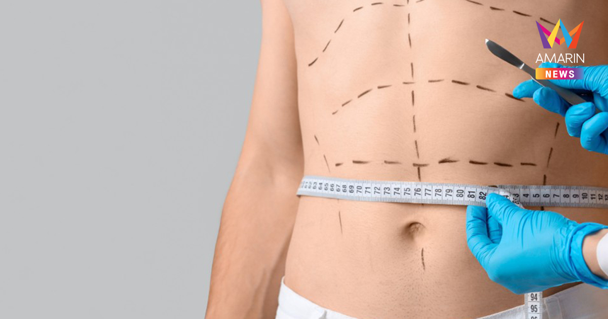 เจาะลึก 7 เหตุผลที่ทำให้โปรแกรมดูดไขมัน ที่ AM International Hospital ครองใจผู้ใช้บริการ