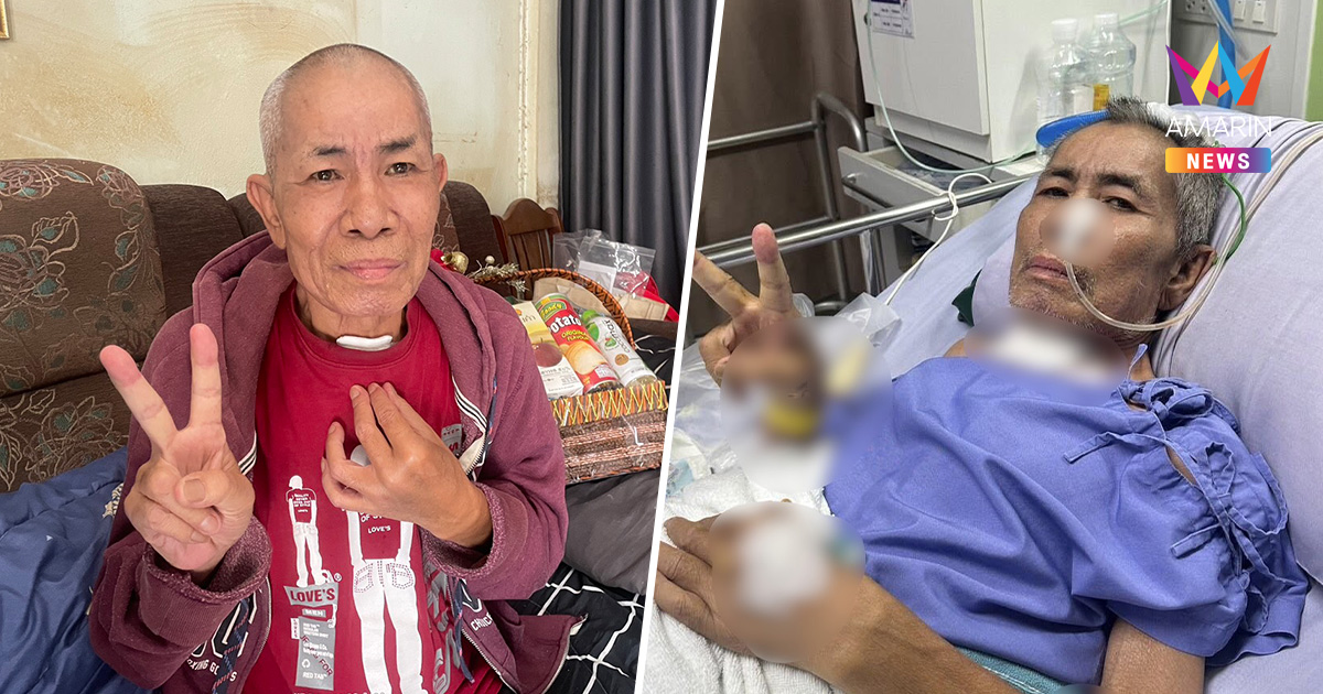 "โอเลี้ยง เชิญยิ้ม" พ้อ ! ไม่อยากเป็นภาระ ล่าสุด เจาะคอจากถุงลมโปงพอง