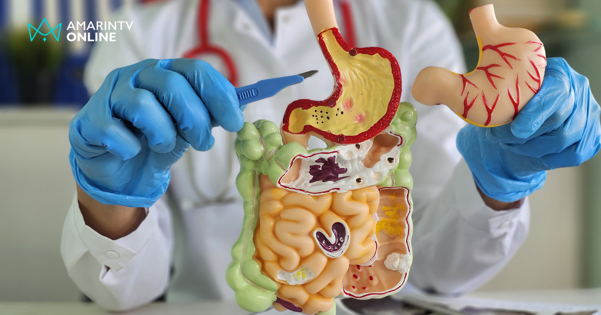 "ผ่าตัดกระเพาะ" ไม่ได้จบแค่ที่ห้องผ่าตัด อันตรายระยะยาวที่ห้ามมองข้าม