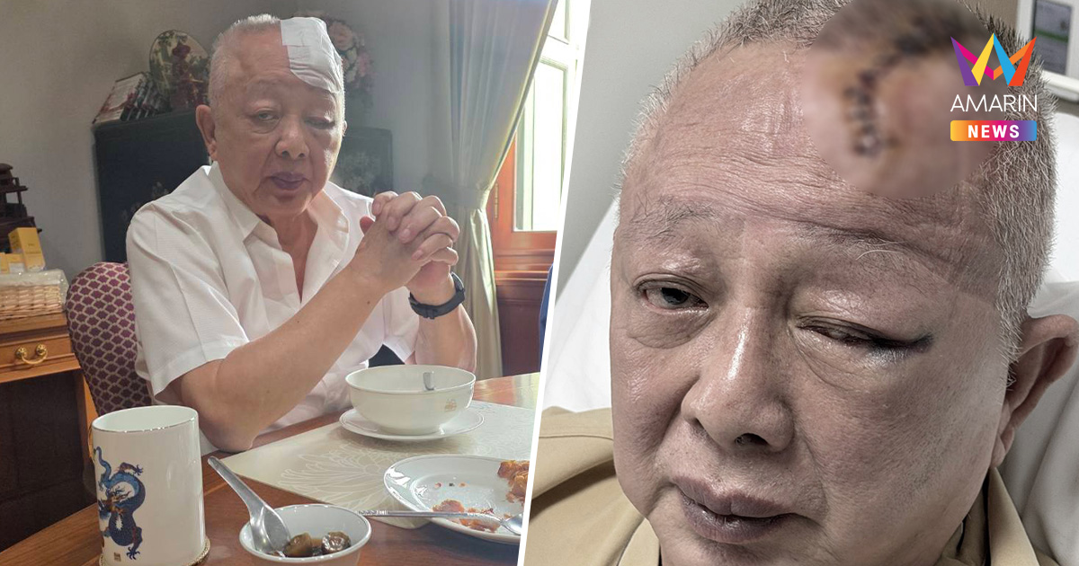 แฟนคลับตกใจ! "สนธิ ลิ้มทองกุล" ประสบอุบัติเหตุล้มหัวฟาดเสาเย็บ 20 เข็ม