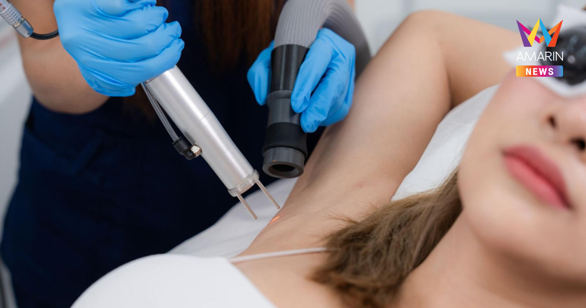 เลเซอร์ขน ที่ไหนดี ? รวม 8 เช็กลิสต์ก่อนตัดสินใจเลือกคลินิก