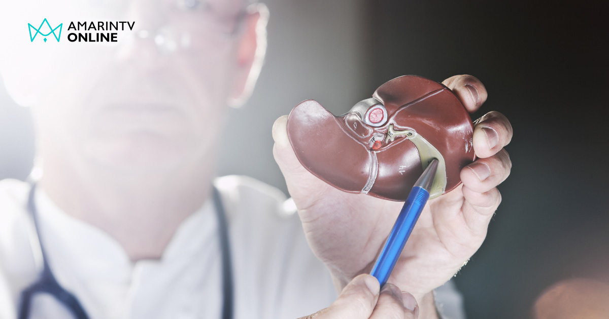 เช็กสัญญาณมะเร็งในถุงน้ำดี ภัยเงียบใกล้ตัวที่มักไร้อาการในระยะแรก