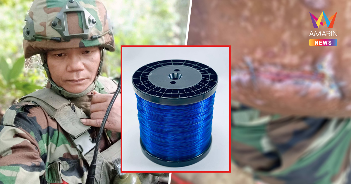 ทหารเขมรครวญ หมอเย็บแผลด้วย "เอ็นตกปลา" หลังเหตุปะทะบนภูเขา 677