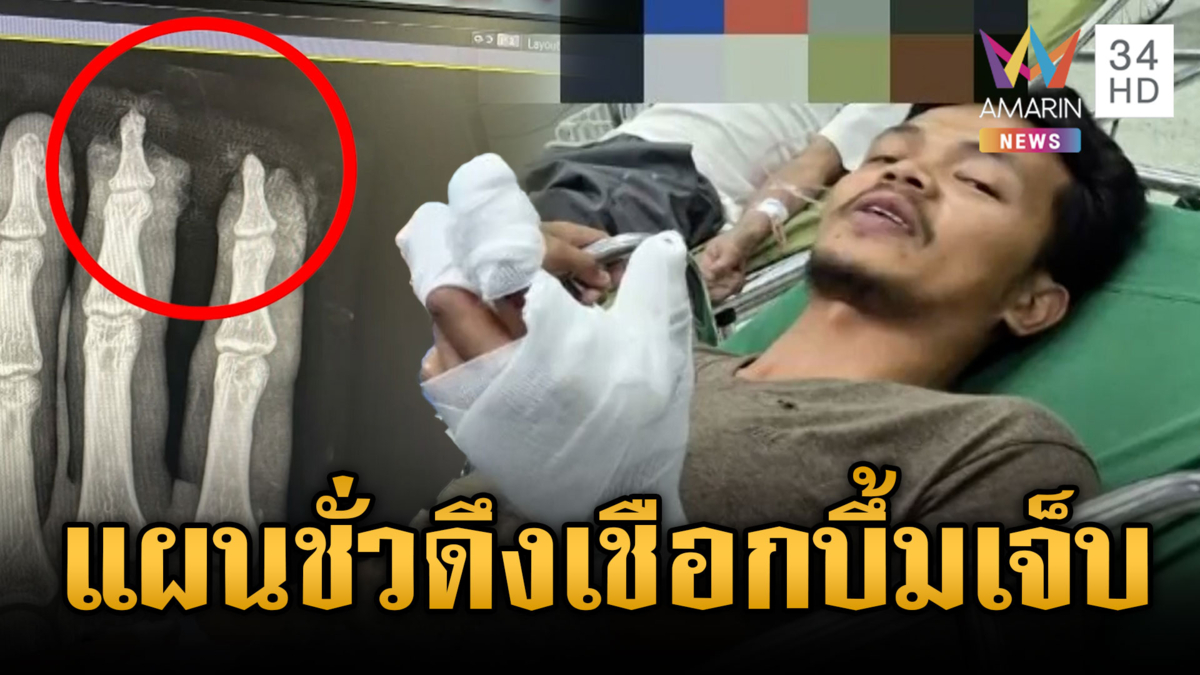 ทหารลาดตระเวนดึงเชือกปริศนาซุกใต้ใบไม้ ระเบิดเจ็บ 1 นาย