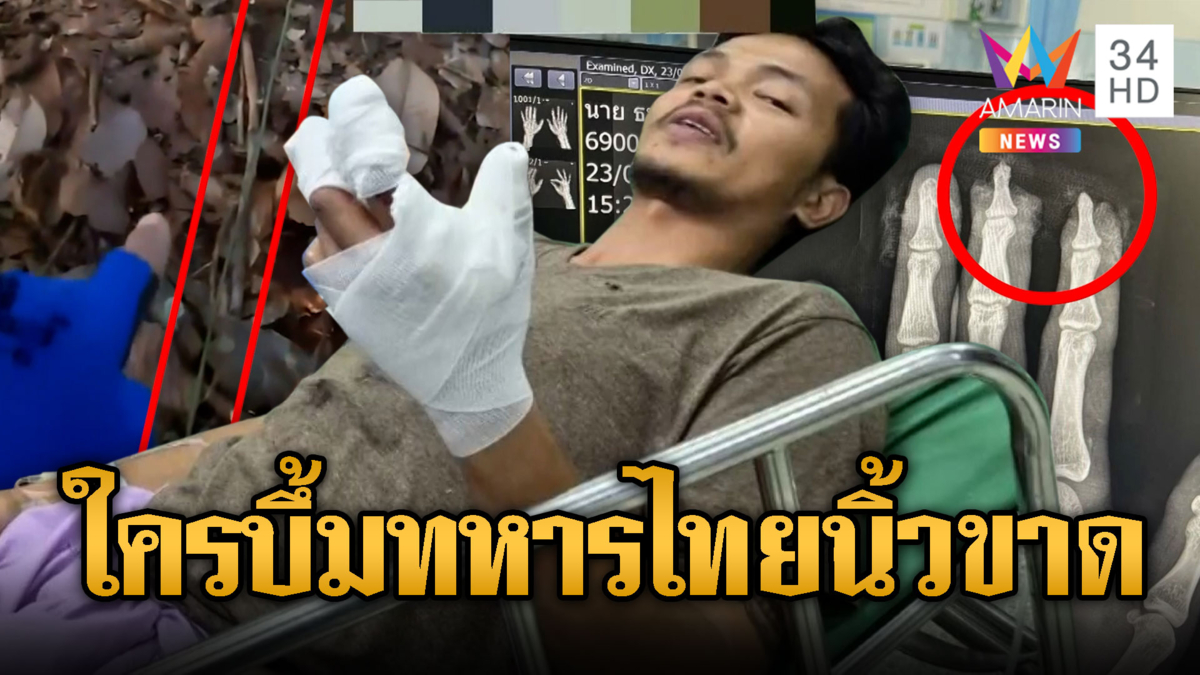 เขมรลอบกัดวางระเบิด ทำเชือกล่อทำทหารไทยนิ้วขาด