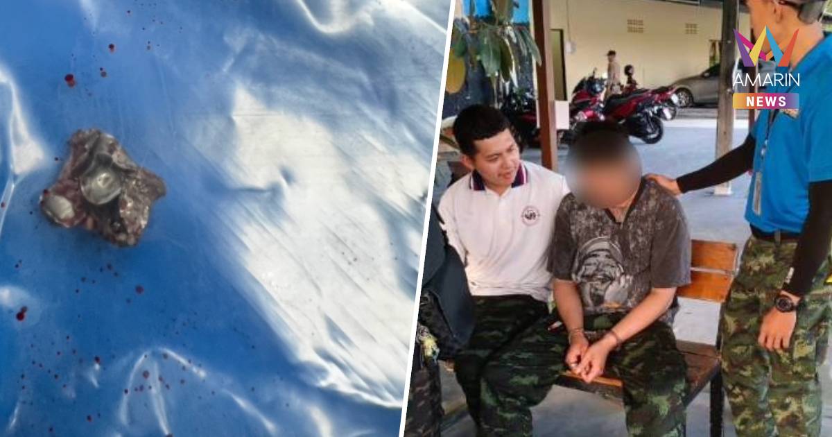 หวาดเสียว ! พนง.สนามยิงปืนทำปืนลั่น กระสุนเจาะแก้มนักท่องเที่ยวสาหัส