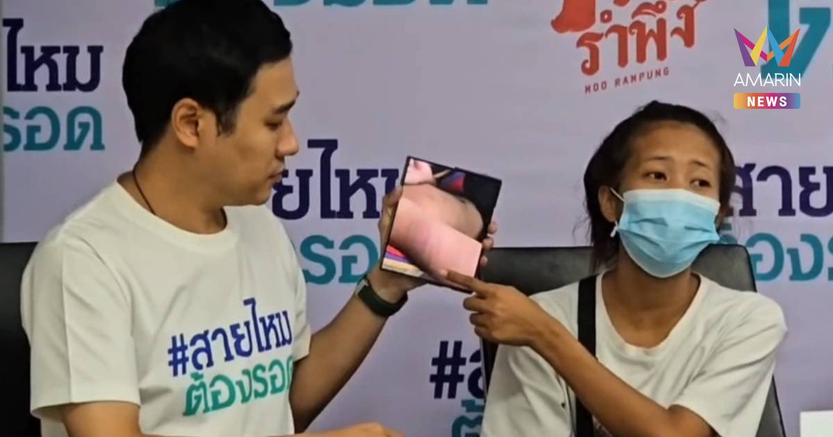 แม่ร้อง ลูกชาย 8 ขวบถูกครูฟาดไม่ยั้ง 17 ครั้ง ร้องไห้กลับบ้าน