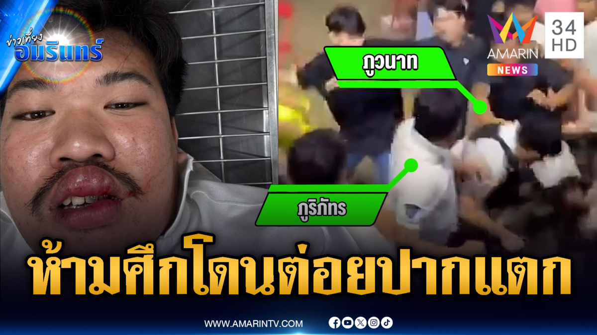 กู้ภัยห้ามศึกวัยรุ่นตีกัน แต่โดนต่อยปากแตกเย็บ 5 เข็ม