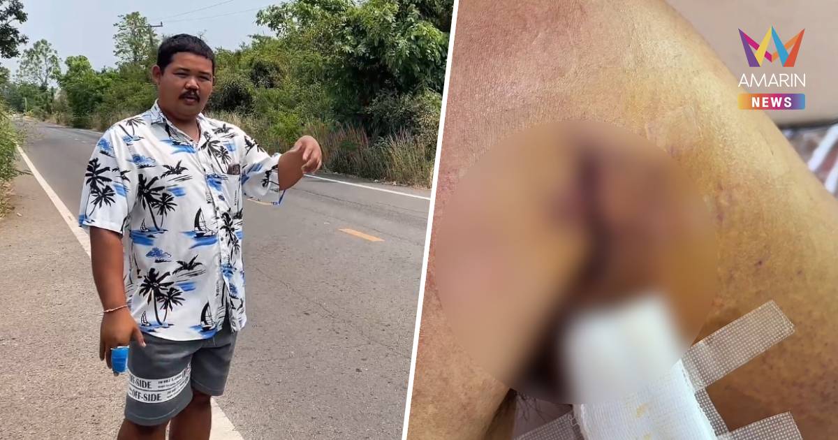 เหล็กปริศนาเสียบไหล่! หนุ่มหวิดดับโดนดักทำร้ายข้างทาง คดีไม่คืบ