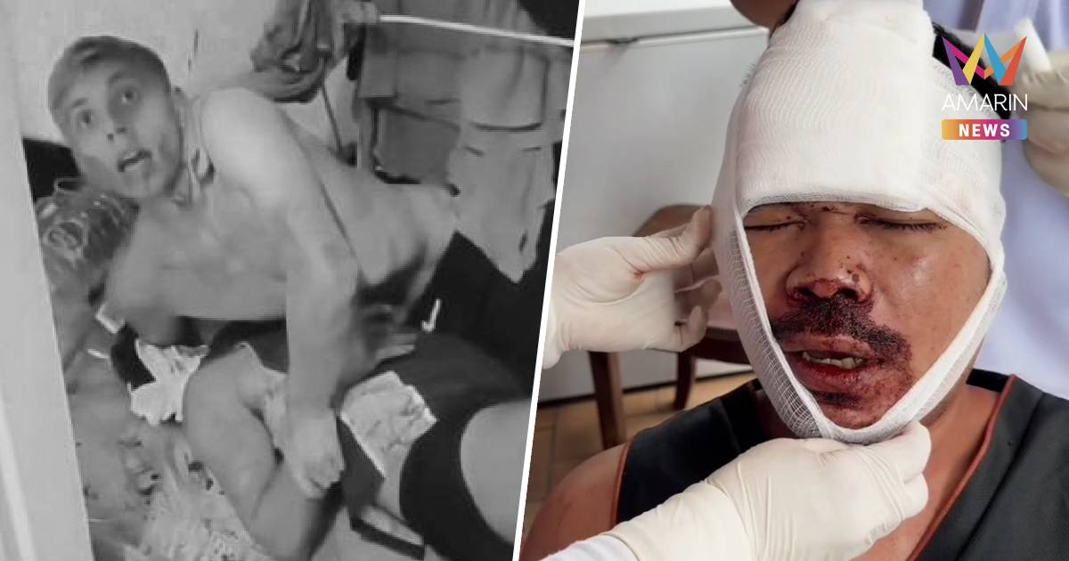 หนุ่มอังกฤษโหด!! บุกห้องเพื่อนซี้ชาวไทย ดัมเบลทุบหัว