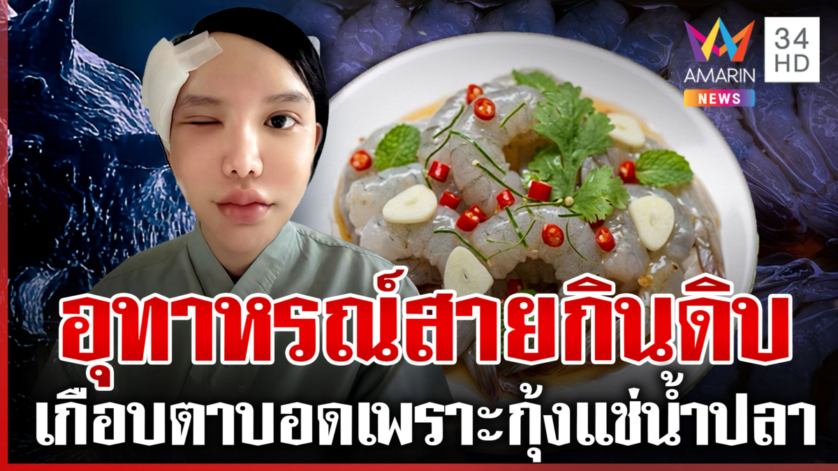 เตือนสายกินดิบ! เกือบตาบอดเพราะกุ้งแช่น้ำปลา ที่ทำกินกันเองที่บ้าน