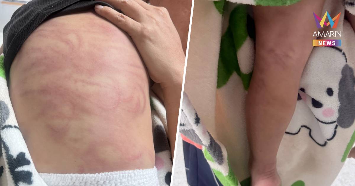 พ่อเลี้ยงคลั่งยา!ทุบเด็ก2ขวบน่วม เพื่อนบ้านทนไม่ไหวโทรตามตาบุกช่วยหลาน