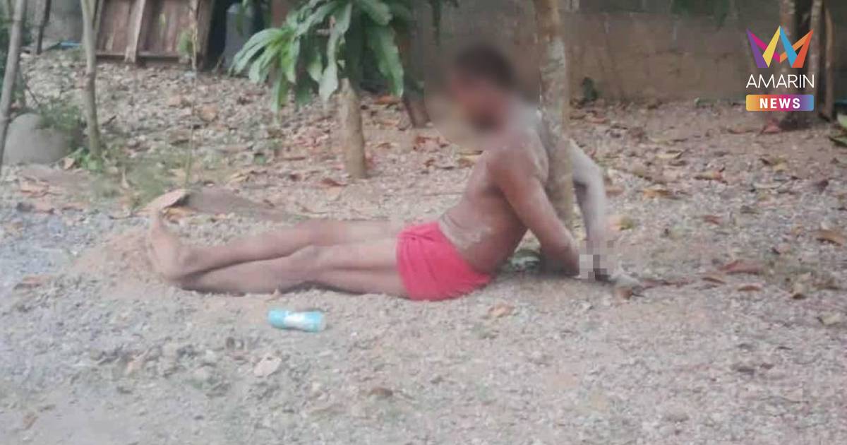 จ่อแจ้งข้อหาหนัก กำนันโหด ปมทารุณหนุ่ม ขยี้รังมดแดงใส่หัว 4 ชม.