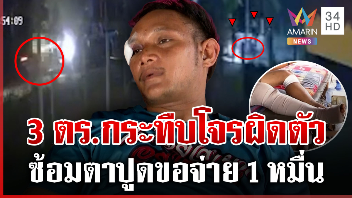 หนุ่มซวย ตร.จับโจรผิดตัวรุมซ้อมแผลเต็มตัว-สั่งตั้ง คกก.สอบวินัย 